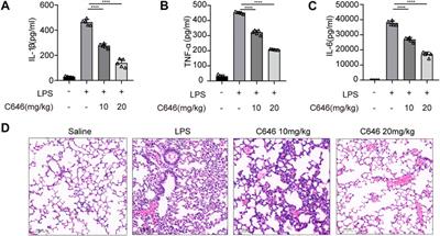 C646 Protects Against DSS-Induced Colitis Model by Targeting NLRP3 Inflammasome